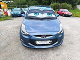 Hyundai ix20 KRÁSNÝ,100TKM,SERVISKA,1MAJ67L - náhled 1