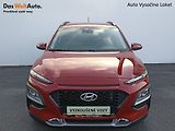 Hyundai Kona (2019) 1.0 T-GDI 88kW tažné manuál - náhled 3
