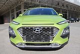 Hyundai Kona 1.6 T-GDI 4×4 | 7DCT | 130 kW - náhled 3
